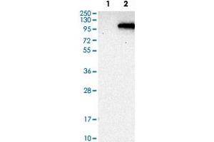 Western Blot analysis of Lane 1: negative control (vector only transfected HEK293T cell lysate) and Lane 2: over-expression lysate (co-expressed with a C-terminal myc-DDK tag in mammalian HEK293T cells) with PDE6A polyclonal antibody . (PDE6A 抗体)