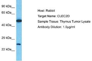 Host: Rabbit Target Name: CLEC2D Sample Type: Thymus Tumor lysates Antibody Dilution: 1. (CLEC2D 抗体  (C-Term))