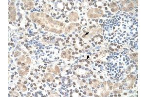 ST8SIA2 antibody was used for immunohistochemistry at a concentration of 4-8 ug/ml to stain Epithelial cells of renal tubule (arrows) in Human Kidney. (ST8SIA2 抗体  (C-Term))