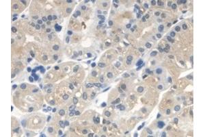 Immunohistochemistry (IHC) image for anti-3-Oxoacid CoA Transferase 1 (OXCT1) (AA 40-489) antibody (ABIN7441481)