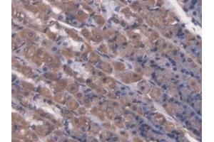Detection of LCT in Rat Stomach Tissue using Polyclonal Antibody to Lactase (LCT) (LCT 抗体  (AA 33-291))