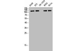 Western Blot analysis of A549 NIH-3T3 SH-SY5Y K562 HELA cells using Phospho-Tensin-2 (Y483) Polyclonal Antibody (TENC1 抗体  (pTyr483))