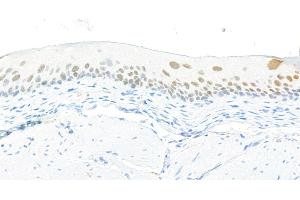 Immunohistochemistry (IHC) image for anti-Forkhead Box Q1 (FOXQ1) (AA 353-403) antibody (ABIN7455177)