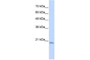 WB Suggested Anti-PFDN6 Antibody Titration: 0. (PFDN6 抗体  (N-Term))
