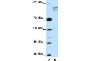 WB Suggested Anti-GTF2I Antibody   Titration: 2. (GTF2I 抗体  (N-Term))