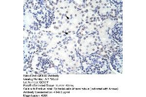 Immunohistochemistry (IHC) image for anti-Glucocorticoid Modulatory Element Binding Protein 2 (GMEB2) (C-Term) antibody (ABIN2780880)