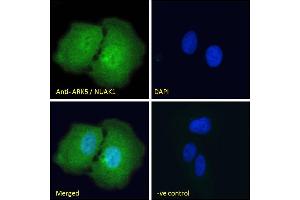 ABIN570930 Immunofluorescence analysis of paraformaldehyde fixed U2OS cells, permeabilized with 0. (NUAK1 抗体  (Internal Region))
