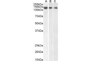 ABIN184570 (1µg/ml) staining of HeLa (A), HepG2 (B) and Jurkat (C) lysate (35µg protein in RIPA buffer). (DDB1 抗体  (C-Term))