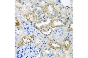 Immunohistochemistry of paraffin-embedded rat kidney using UQCR10 antibody at dilution of 1:100 (x40 lens). (UQCR10 抗体)