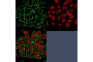 Immunofluorescence (IF) image for anti-Moesin (MSN) antibody (ABIN6940085)
