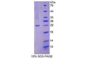 SDS-PAGE (SDS) image for Nitric Oxide Synthase 2, Inducible (NOS2) (AA 533-696) protein (His tag) (ABIN1878123) (NOS2 Protein (AA 533-696) (His tag))