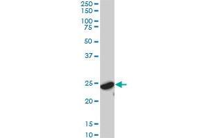 YWHAG monoclonal antibody (M02), clone 6A10. (14-3-3 gamma 抗体  (AA 70-169))