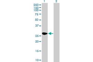 Western Blot analysis of SEC22A expression in transfected 293T cell line by SEC22A MaxPab polyclonal antibody. (SEC22A 抗体  (AA 1-307))