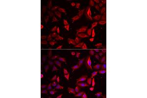 Immunofluorescence analysis of HeLa cell using SERPINB9 antibody. (SERPINB9 抗体)