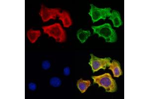 ABIN6262671 and ABIN6273002 staining Hela cells by IF/ICC.