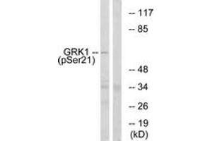 Western blot analysis of extracts from COS7 cells treated with TNF 20ng/ml 5', using GRK1 (Phospho-Ser21) Antibody. (GRK1 抗体  (pSer21))