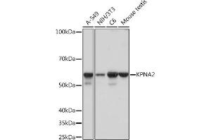 Western blot analysis of extracts of various cell lines, using KPN Rabbit mAb (ABIN1680520, ABIN3019328, ABIN3019329 and ABIN7101751) at 1:1000 dilution. (KPNA2 抗体)