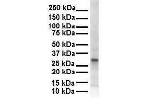 WB Suggested Anti-ECHDC2 antibody Titration: 1 ug/mL Sample Type: Human 721_B (ECHDC2 抗体  (Middle Region))