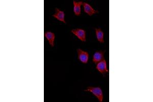 ABIN6265621 and ABIN6272881 staining HepG2 by IF/ICC.