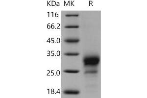 Western Blotting (WB) image for Tumor Necrosis Factor Receptor Superfamily, Member 19 (TNFRSF19) protein (His tag) (ABIN7198467)