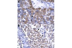 Immunohistochemical staining (Formalin-fixed paraffin-embedded sections) of human liver (A) and human muscle (B) with ERCC8 polyclonal antibody  at 4-8 ug/mL working concentration. (ERCC8 抗体  (C-Term))