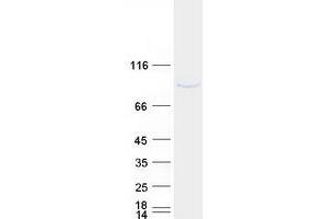 Western Blotting (WB) image for UV Stimulated Scaffold Protein A (UVSSA) protein (Myc-DYKDDDDK Tag) (ABIN2724212)