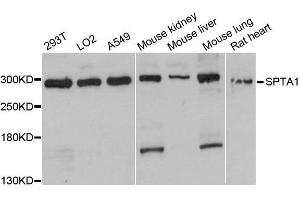 Western blot analysis of extracts of various cell lines, using SPTA1 antibody. (SPTA1 抗体  (AA 940-1160))