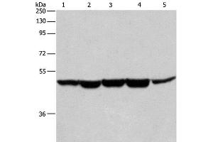 Western Blot analysis of Human bladder cancer tissue, A375, K562, Hela and HepG2 cell using HNRNP F Polyclonal Antibody at dilution of 1:350 (HNRNPF 抗体)