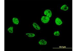 Immunofluorescence of purified MaxPab antibody to CIP29 on HeLa cell. (SARNP 抗体  (AA 1-210))