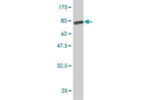Western Blotting (WB) image for anti-Calreticulin 3 (CALR3) (AA 21-384) antibody (ABIN530566)