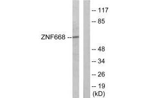Western blot analysis of extracts from Jurkat cells, using ZNF668 antibody. (ZNF668 抗体)