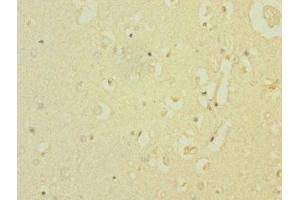 Immunohistochemistry (IHC) image for anti-Sodium Channel, Voltage-Gated, Type VIII, alpha (SCN8A) (AA 1350-1440) antibody (ABIN7169927)