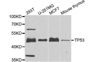 Western blot analysis of extracts of various cells, using TP53 antibody. (p53 抗体)