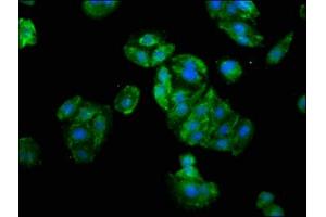 Immunofluorescence staining of HepG2 cells with ABIN7176574 at 1:133, counter-stained with DAPI. (GLI1 抗体  (AA 921-1106))