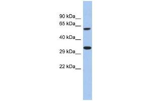 FAM26A antibody used at 1 ug/ml to detect target protein. (CALHM3 抗体  (C-Term))