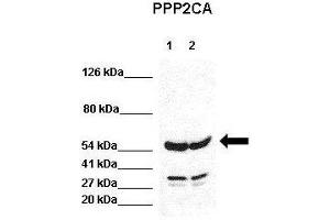 WB Suggested Anti-PPP2CA Antibody  Positive Control: Lane 1:441 µg HEK293 lysate Lane 2: 041 µg H1299 lysate Primary Antibody Dilution: 1:0000Secondary Antibody: Goat anti-rabbit-HRP Secondry  Antibody Dilution: 1:0000Submitted by: Jose Luis Rosa, Universitat de Barcelona (PPP2CA 抗体  (N-Term))