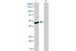 Western Blot analysis of PPM1F expression in transfected 293T cell line by PPM1F monoclonal antibody (M01), clone 2A9.