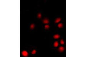 Immunofluorescent analysis of p14 ARF staining in K562 cells. (CDKN2A 抗体  (Center))