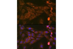Immunofluorescence (IF) image for anti-Signal Transducer and Activator of Transcription 4 (STAT4) antibody (ABIN1681118)