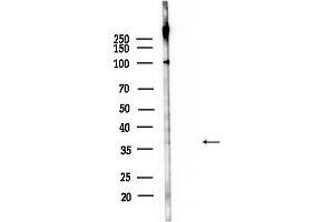 Western blot analysis of lysates from F10-LUC cells(heat-shock,45 min treatment), using ACP5 Antibody at 1/1000 dilution.