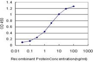 Detection limit for recombinant GST tagged PRKCD is approximately 0. (PKC delta 抗体  (AA 577-676))