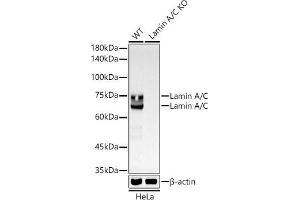 Western blot analysis of extracts from wild type (WT) and Lamin A/C knockout (KO) HeLa cells, using Lamin A/C antibody (ABIN7268177) at 1:500000 dilution.