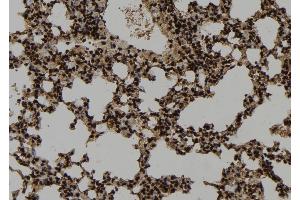 ABIN6273346 at 1/100 staining Mouse lung tissue by IHC-P. (WDR18 抗体  (Internal Region))