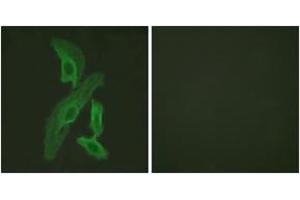 Immunofluorescence analysis of HeLa cells, using BCL-XL (Ab-47) Antibody. (BCL2L1 抗体  (AA 13-62))