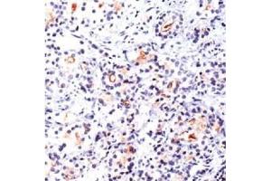 Image no. 1 for anti-Folate Hydrolase (Prostate-Specific Membrane Antigen) 1 (FOLH1) antibody (ABIN372967) (PSMA 抗体)
