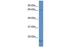 Western Blotting (WB) image for anti-Potassium Voltage-Gated Channel, Shaker-Related Subfamily, Member 5 (KCNA5) (N-Term) antibody (ABIN2778214)