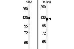 (LEFT) Western blot analysis of anti-VINC Antibody (N-term) in K562 cell line lysates (35ug/lane). (Vinculin 抗体  (N-Term))