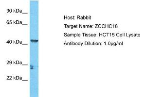Host: Rabbit Target Name: ZCCHC18 Sample Tissue: Human HCT15 Whole Cell  Antibody Dilution: 1ug/ml (ZCCHC18 抗体  (C-Term))