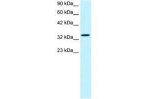 Western Blotting (WB) image for anti-SMAD, Mothers Against DPP Homolog 6 (SMAD6) antibody (ABIN2460536) (SMAD6 抗体)