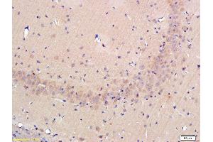 Formalin-fixed and paraffin-embedded rat hippocampus labeled with Rabbit Anti-OPN Polyclonal Antibody, Unconjugated (ABIN723800) at 1:300 followed by conjugation to the secondary antibody (Osteopontin 抗体  (AA 221-280))